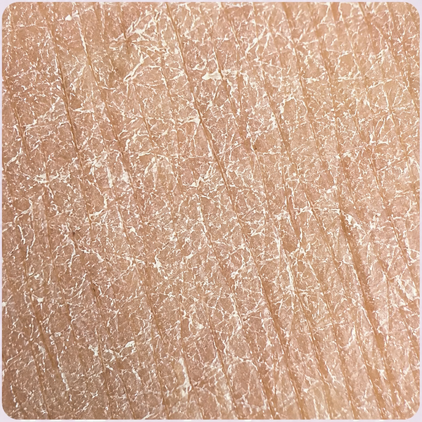 DULL, DEHYDRATED COMPLEXION