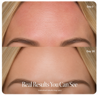Anti-Redness Led Therapy Face Mask 4